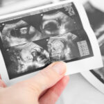 ADF comment on US Supreme Court oral arguments in Dobbs v. Jackson Women’s Health Organization